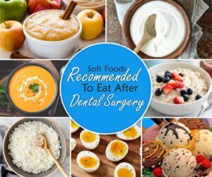 50 soft foods to eat after tooth extraction and Smooth Recovery